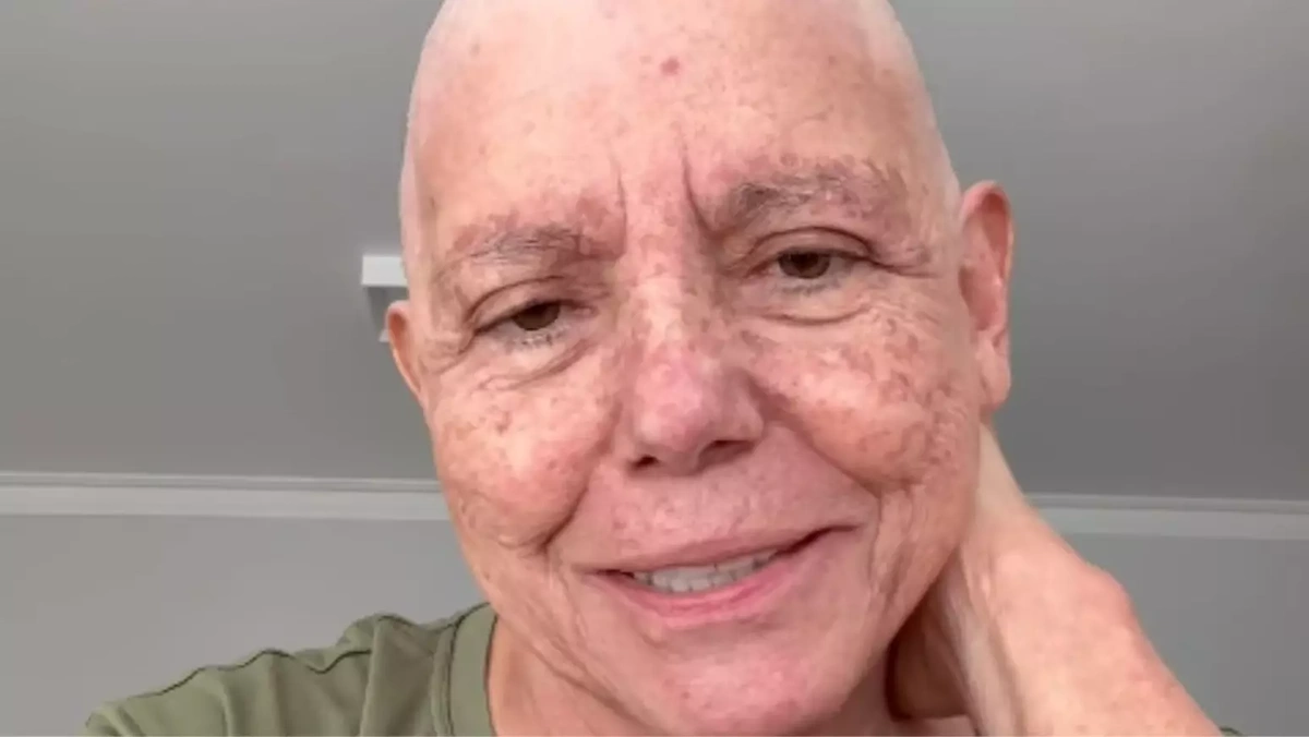 Roseana Sarney conta que assumiu o tratamento contra o câncer ainda em 2025