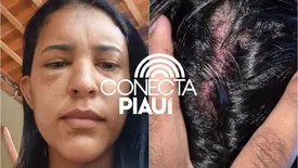 Secretária de Saúde tem casa invadida e é espancada pelo ex-namorado no Piauí (Foto: Reprodução)