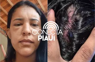 Secretária de Saúde tem casa invadida e é espancada pelo ex-namorado no Piauí (Foto: Reprodução)