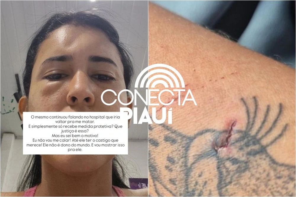 Secretária de Saúde tem casa invadida e é espancada pelo ex-namorado no Piauí