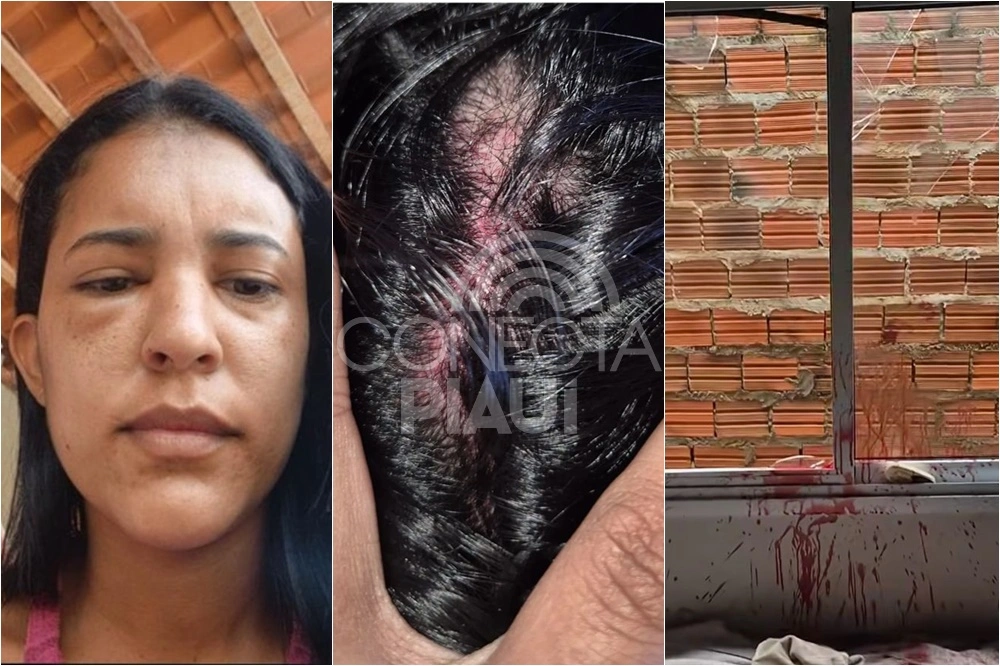 Secretária de Saúde tem casa invadida e é espancada pelo ex-namorado no Piauí