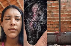Secretária de Saúde tem casa invadida e é espancada pelo ex-namorado no Piauí