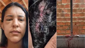 Secretária de Saúde tem casa invadida e é espancada pelo ex-namorado no Piauí (Foto: Reprodução)