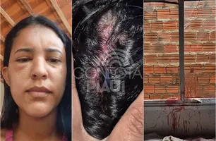 Secretária de Saúde tem casa invadida e é espancada pelo ex-namorado no Piauí (Foto: Reprodução)