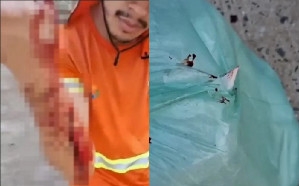 Vidro descartado de forma irregular fere trabalhador da coleta de lixo em Teresina