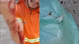Vidro descartado de forma irregular fere trabalhador da coleta de lixo em Teresina (Foto: Reprodução)
