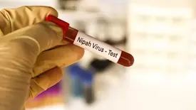 Vírus Nipah (Foto: iStock)