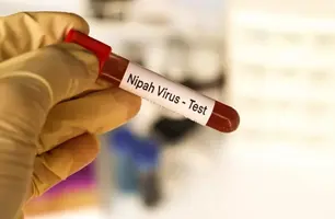 Vírus Nipah (Foto: iStock)
