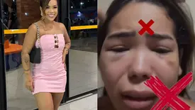 Blogueira denuncia agressões do companheiro em Teresina (Foto: Reprodução)