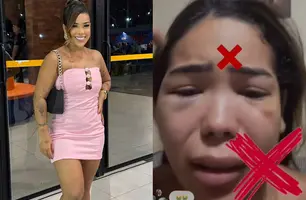 Blogueira denuncia agressões do companheiro em Teresina (Foto: Reprodução)