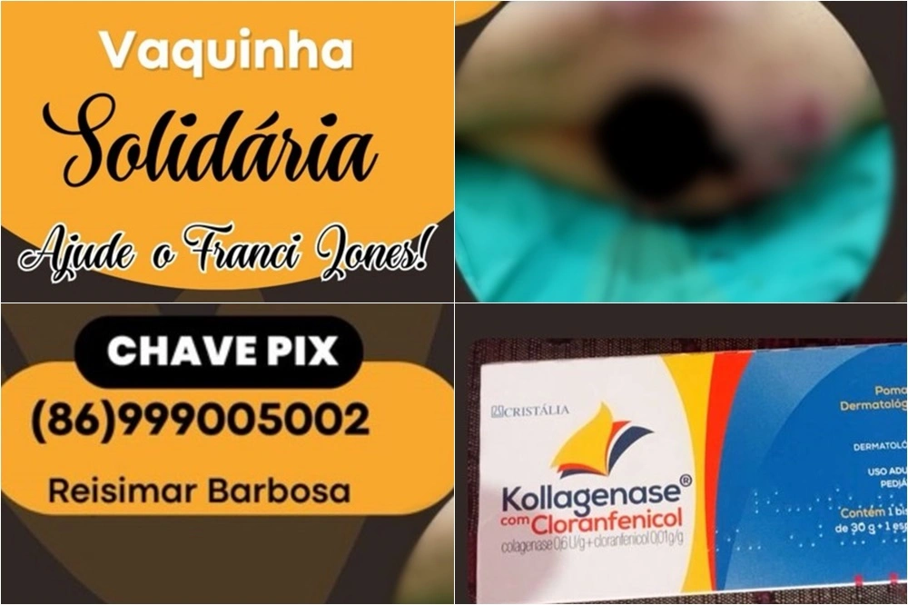 Campanha é realizada para ajudar jovem cadeirante com lesões em hospital de THE