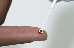 Prefeitura de Beneditinos reforça prevenção às ISTs durante Carnaval