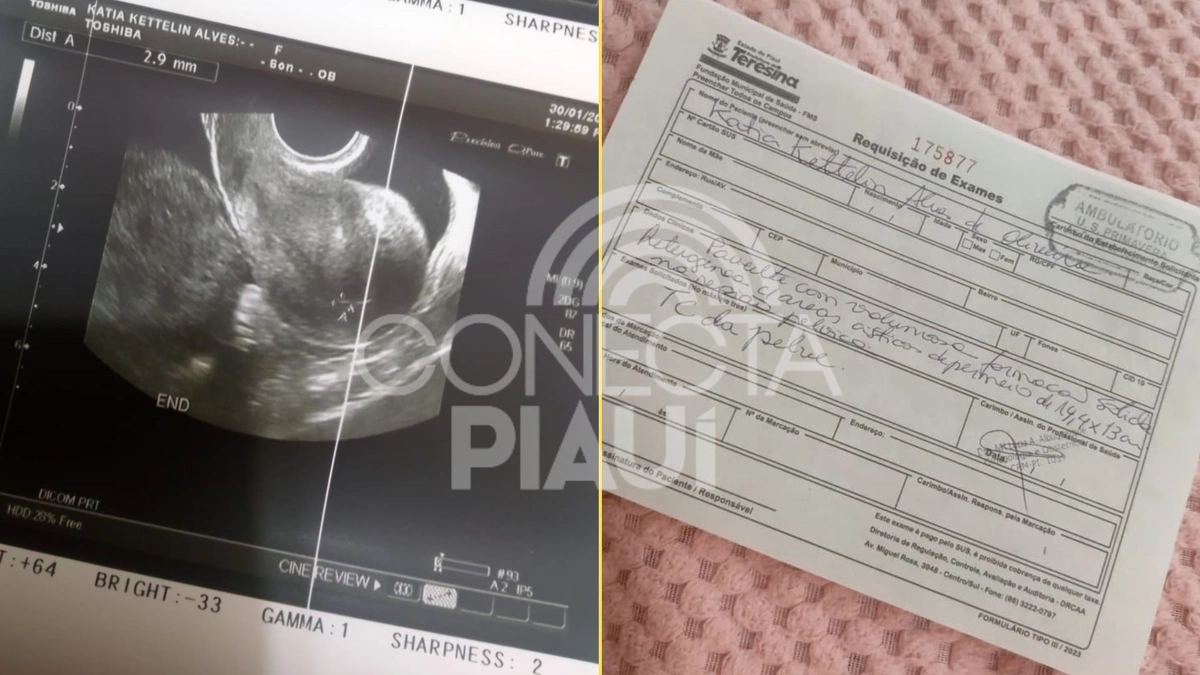 Mãe faz apelo por ajuda para tratamento da filha com cisto de 15 cm