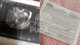 Mãe faz apelo por ajuda para tratamento da filha com cisto de 15 cm (Foto: Reprodução)