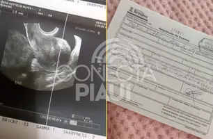 Mãe faz apelo por ajuda para tratamento da filha com cisto de 15 cm (Foto: Reprodução)