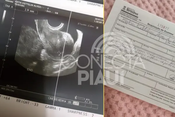 Mãe faz apelo por ajuda para tratamento da filha com cisto de 15 cm