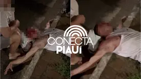 Motociclista colide em poste e homem fica gravemente ferido em Campo Maior (Foto: Reprodução)