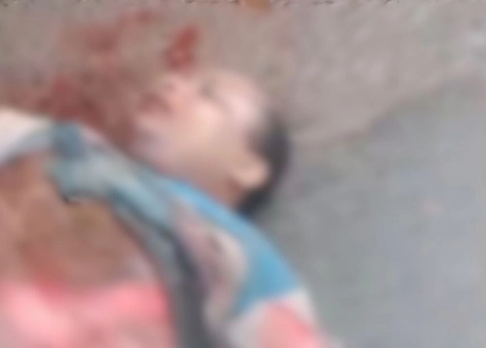 Motociclista fica gravemente ferido após acidente com ônibus, em Timon