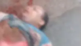 Motociclista fica gravemente ferido após acidente com ônibus, em Timon (Foto: Reprodução)