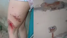 Mulher fica ferida após raio atingir residência na zona rural de Buriti dos Lopes (Foto: Reprodução)