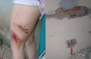 Mulher fica ferida após raio atingir residência na zona rural de Buriti dos Lopes (Foto: Reprodução)