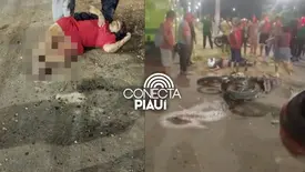 Mulher sofre fratura exposta após colisão com ônibus na zona Norte de Teresina (Foto: Reprodução)