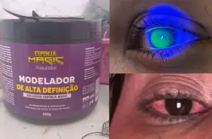 Risco no Carnaval: pomadas de cabelo causam reação em olhos de foliãs no Piauí (Foto: Conecta Piauí)