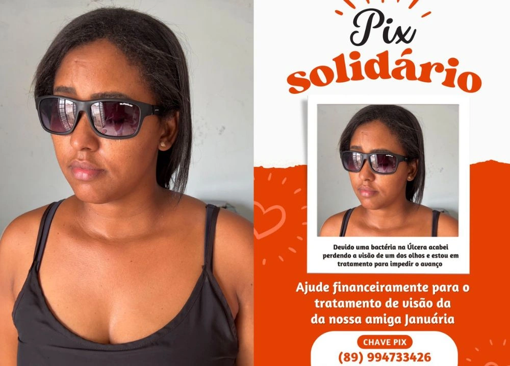 Cabeleireira de Oeiras busca ajuda para tratar infecção que afetou visão