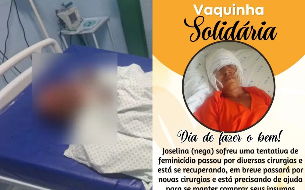 Demerval Lobão: vítima de tentativa de feminicídio faz vaquinha para cirurgias