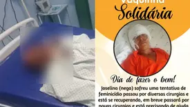 Demerval Lobão: vítima de tentativa de feminicídio faz vaquinha para cirurgias (Foto: Reprodução)