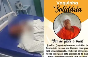 Demerval Lobão: vítima de tentativa de feminicídio faz vaquinha para cirurgias (Foto: Reprodução)