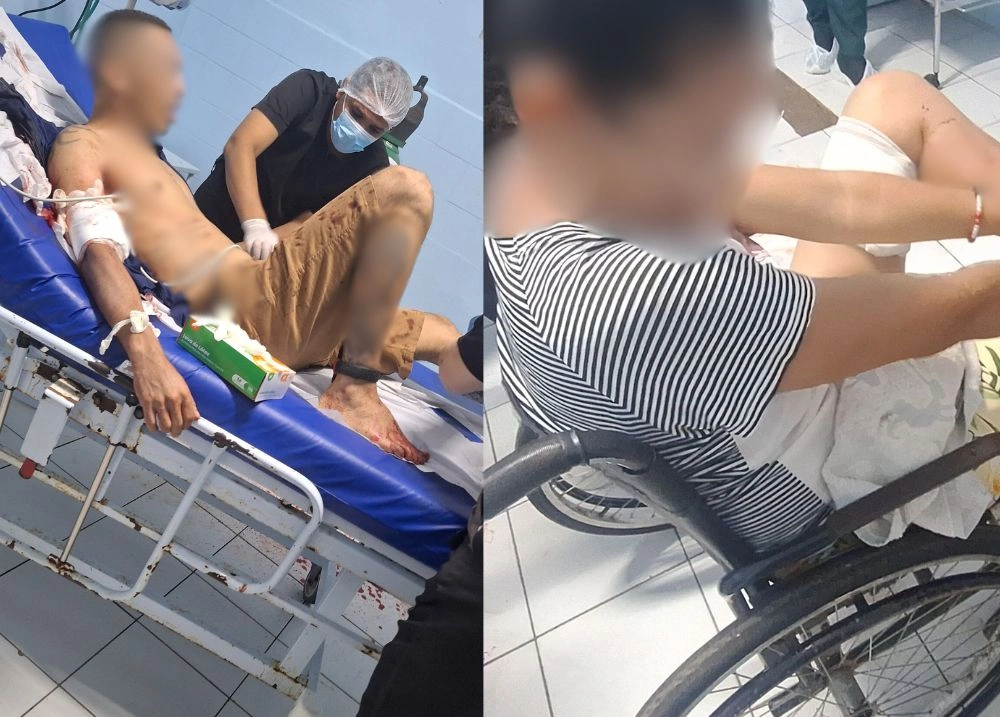 Duas pessoas ficam feridas após tiros dentro de casa em Demerval Lobão