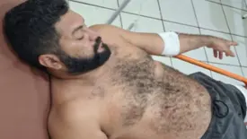 Homem é baleado no interior do Piauí e caso envolve denúncias de perseguição (Foto: FM Imperial)