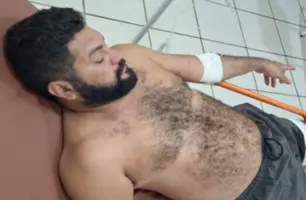 Homem é baleado no interior do Piauí e caso envolve denúncias de perseguição (Foto: FM Imperial)