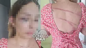 Homem é preso por agredir ex com barra de ferro em Teresina (Foto: Reprodução)