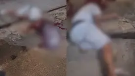 Jovem é baleado na cabeça na zona Norte de Teresina e está na UTI (Foto: Reprodução)