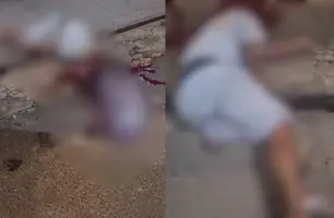 Jovem é baleado na cabeça na zona Norte de Teresina e está na UTI (Foto: Reprodução)