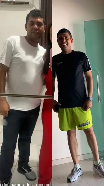 Médico de Bom Jesus se destaca no tratamento da obesidade no Nordeste