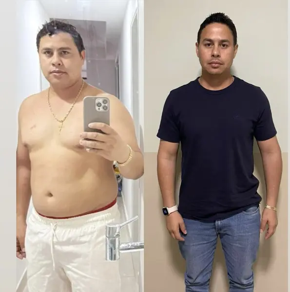 Médico de Bom Jesus se destaca no tratamento da obesidade no Nordeste