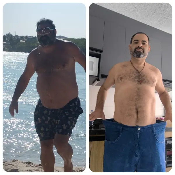 Médico de Bom Jesus se destaca no tratamento da obesidade no Nordeste