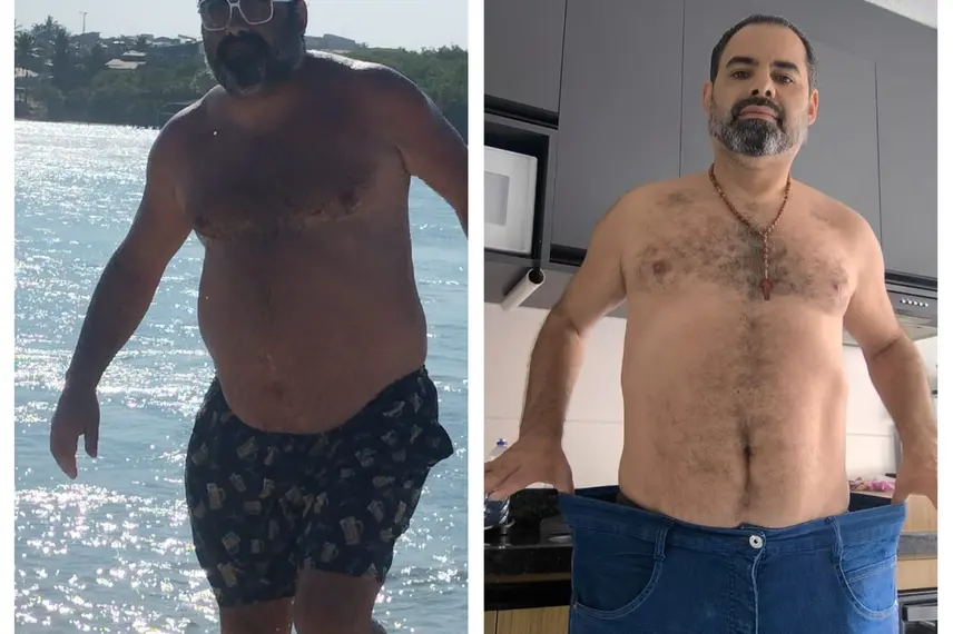 Médico de Bom Jesus se destaca no tratamento da obesidade no Nordeste