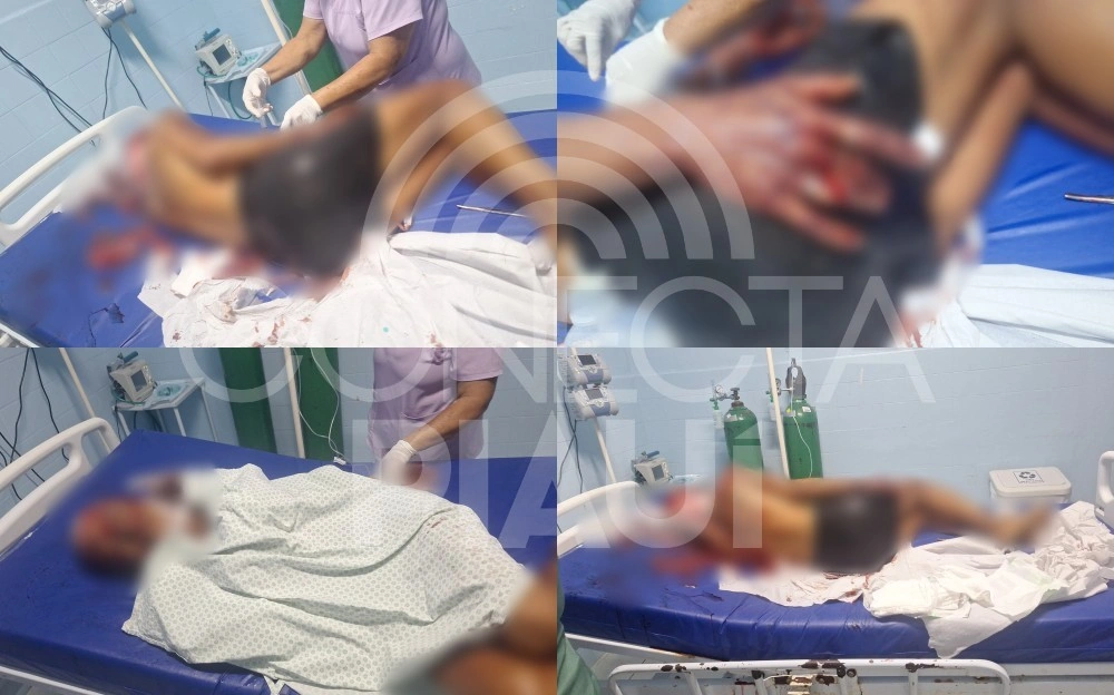 Mulher é ferida com vários golpes de facão após encontro sexual em Demerval Lobão