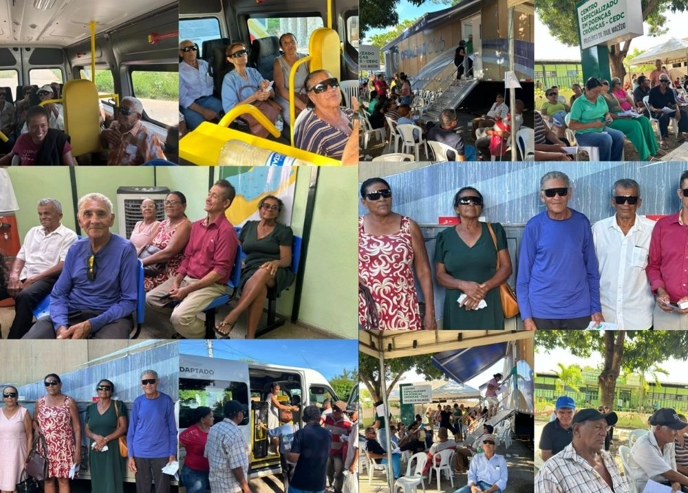 Mutirão de catarata amplia acesso à saúde em Anísio de Abreu