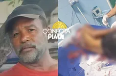 Polícia divulga imagens de suspeito de agredir mulher com facão em Demerval Lobão