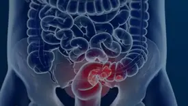 Rastreio e prevenção do câncer de colorretal (Foto: Câmara Municipal de Afonso Claudio/Divulgação)