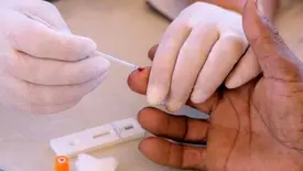 SUS amplia diagnóstico de dengue com teste rápido disponível na rede pública (Foto: Reprodução/ Google)