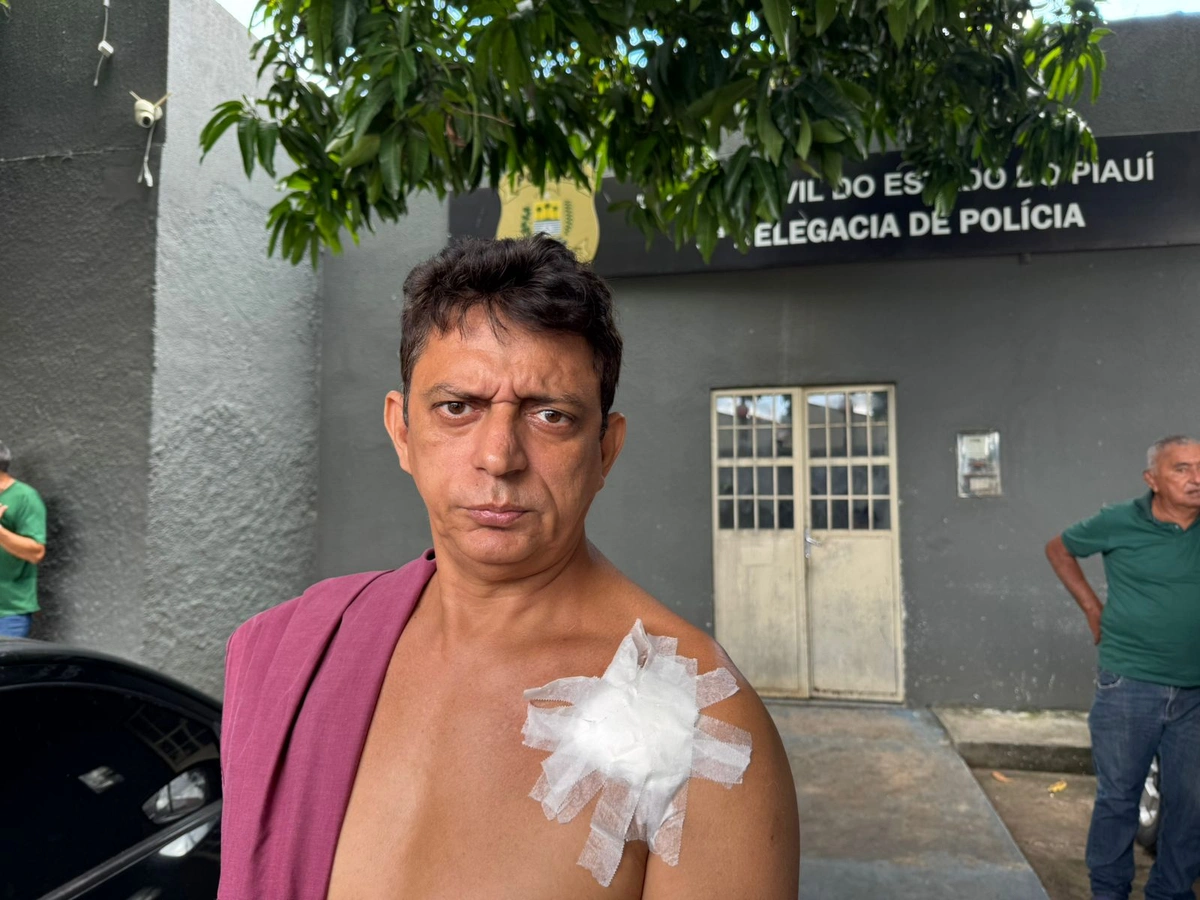 Homem foi baleado por motorista por Aplicativo em Teresina