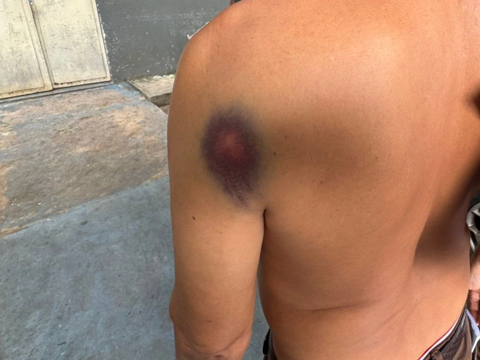 Homem foi baleado por motorista por Aplicativo em Teresina