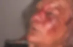 Idosa é rendida, amarrada e agredida durante assalto dentro de casa no Piauí