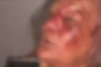 Idosa é rendida, amarrada e agredida durante assalto dentro de casa no Piauí